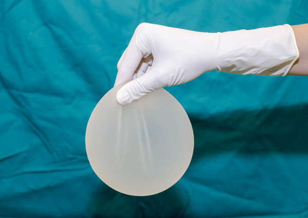 Breast Implants طرح توجیهی تولید ایمپلنت سینه پروتز پستان